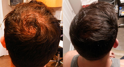 Chronic Pain St. Petersburg FL Aesthetic Hair Services Chronic Pain St. Petersburg FL Aesthetic Hair Services