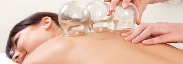 Chronic Pain St. Petersburg FL Cupping Therapy Chronic Pain St. Petersburg FL Cupping Therapy